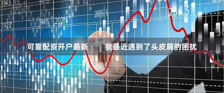 可靠配资开户最新        我最近遇到了头皮屑的困扰